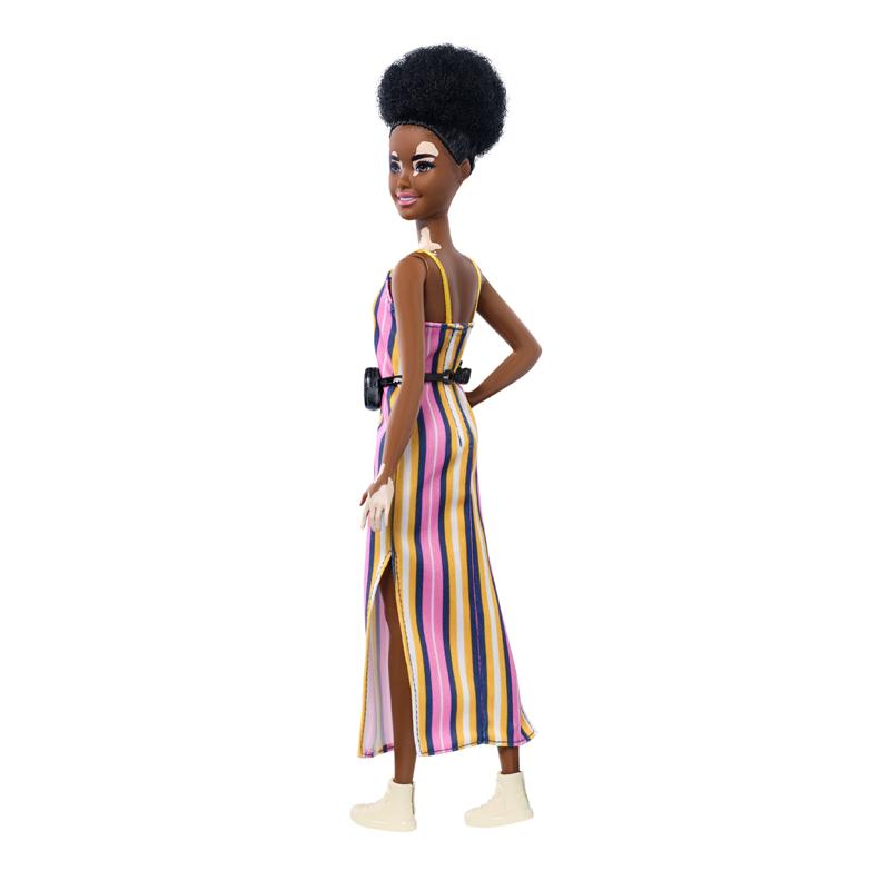 Barbie Fashionistas Vitiligo Anne Claire Baby Store