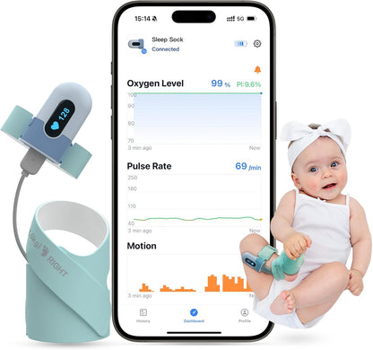 Babytone Oxímetro de pulso para bebês, meia inteligente para bebês com monitoramento de nível de oxigênio, frequência cardíaca e pulso, monitor de pés infantil vestível com aplicativo Bluetooth para recém-nascidos de 0 a 36 meses