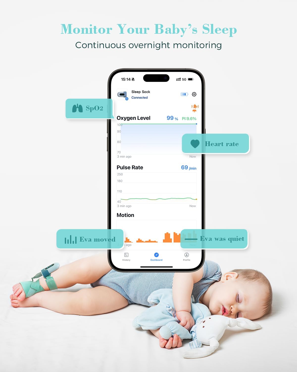 Babytone Oxímetro de pulso para bebês, meia inteligente para bebês com monitoramento de nível de oxigênio, frequência cardíaca e pulso, monitor de pés infantil vestível com aplicativo Bluetooth para recém-nascidos de 0 a 36 meses