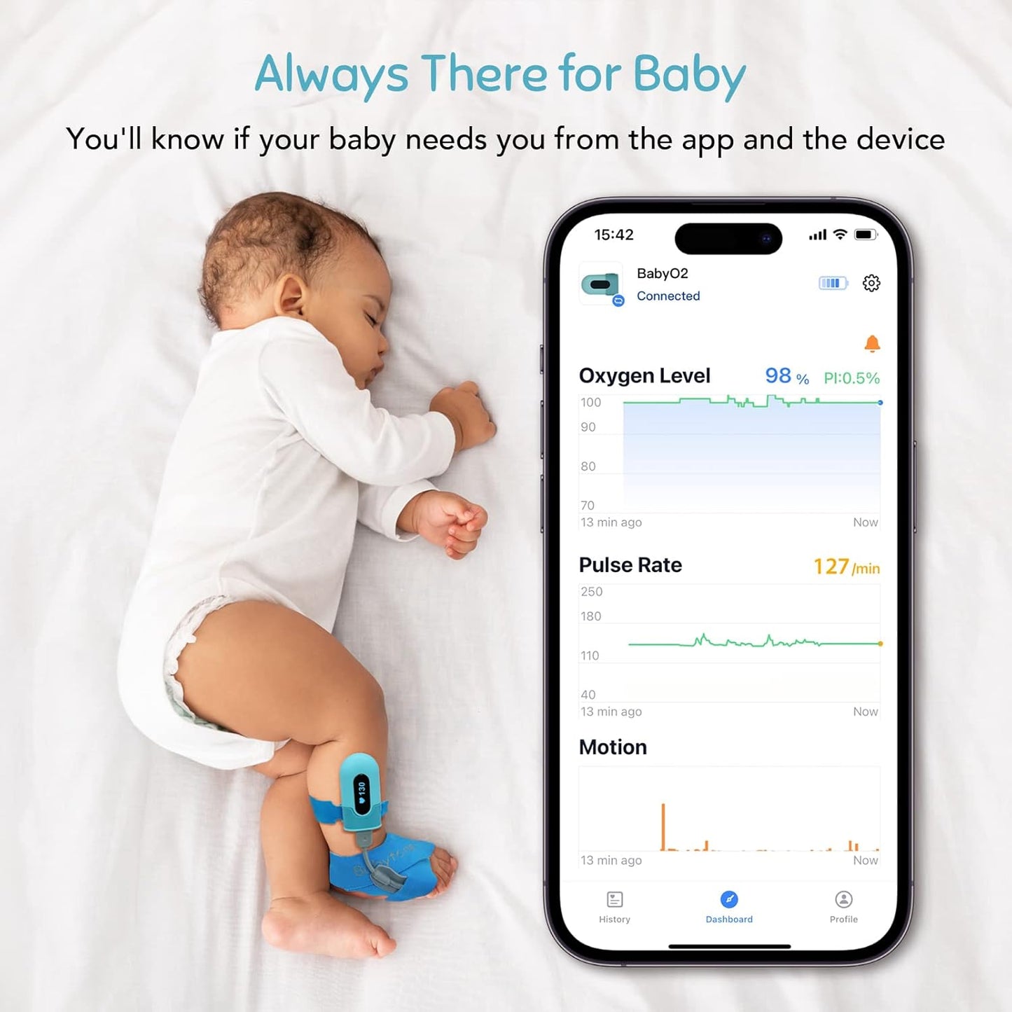 Babytone Oxímetro de pulso para bebês, meia inteligente para bebês com monitoramento de nível de oxigênio, frequência cardíaca e movimento, monitor de pés infantil vestível com aplicativo Bluetooth para recém-nascidos de 0 a 36 meses