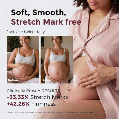 Momcozy Creme para Estrias na Gravidez, Hidratante Firmador Pró-Colágeno para Pele Seca, Gravidez e Pós-Parto, Suaviza a Aparência de Estrias, Rugas no Pescoço e Linhas Finas, 30g